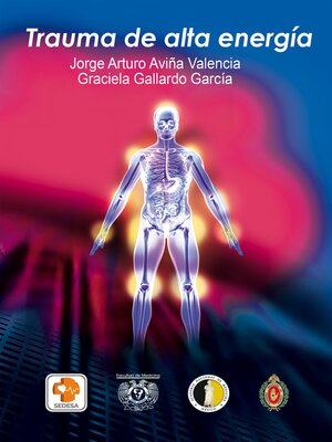 cover image of Trauma de alta energía